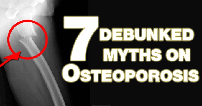 CoverPhoto Myths of Osteoporosis copy